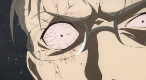 Sword Art Online Damaged Eye Sword Art Online Damaged Eye
